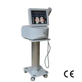 Nasolabial Fold Removal HIFU Machine Hifu High Intensity Focused Ultrasound