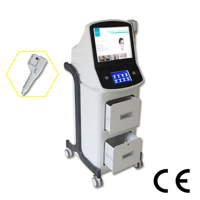 High Frequency Face Machine Malar Augmentation Nasolabial Fold Removal